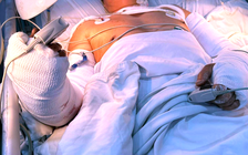 Bệnh viện Chấn thương chỉnh hình TP.HCM cứu bệnh nhân bị máy cắt lìa 2 cẳng tay