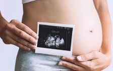 Người phụ nữ 'mang thai đá' 9 năm, tử vong do suy dinh dưỡng