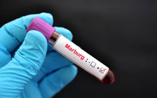 Virus Marburg: Không mới nhưng rất nguy hiểm, tỷ lệ tử vong cao