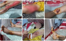 Thực hư thông tin 'con tra tấn mẹ bằng cách lấy xe máy kéo lê trên đường'