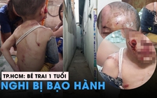 Làm rõ vụ bé trai hơn 1 tuổi nghi bị bạo hành tại TP.HCM