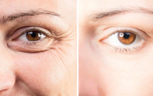 Nghiên cứu: Ăn loại trái cây này, giúp bạn đẩy lùi nếp nhăn