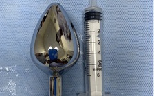 Thiếu niên 15 tuổi bị kẹt 'đồ chơi' hình trái tim trong hậu môn