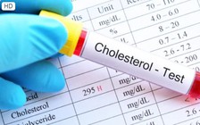 Chuyên gia chia sẻ 4 món ăn sáng giúp giảm cholesterol