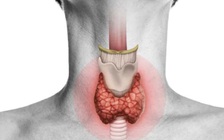 Tiêu chảy kéo dài có thể là dấu hiệu cảnh báo ung thư tuyến giáp