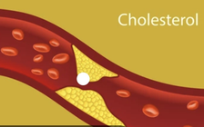 Loại trái cây này có thể giúp giảm mức cholesterol cao