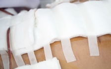 Vụ hút mỡ bị thủng bụng, mất 6 lít máu, hôn mê: Niêm phong hồ sơ bệnh án