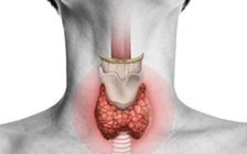 Ung thư tuyến giáp: Triệu chứng xuất hiện trên da mặt không được bỏ qua