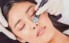 Chăm sóc da chuyên sâu với công nghệ cao cấp HydraFacial vì sao được ưa chuộng?