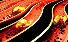 3 món ăn sáng giúp giảm mức cholesterol cao