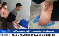 Xem nhanh 12h: Tước danh hiệu CAND một thượng úy | Phát hiện ca đậu mùa khỉ nội địa đầu tiên