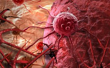 Ngày mới với tin tức sức khỏe: Tìm ra cách tiêu diệt nhanh tế bào ung thư