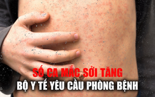 Số ca mắc bệnh Sởi trên thế giới tăng đột biến, Bộ Y tế yêu cầu tăng cường phòng bệnh