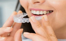4 cách giúp giữ hàm răng khỏe mạnh đến già