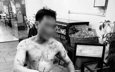 Một thanh niên bị hành hung dã man tại phòng trà