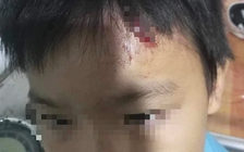 Xác minh vụ nghi vấn mẹ kế tái diễn bạo hành con chồng