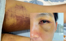 Lâm Đồng: Bắt giữ chồng cũ nạn nhân trong vụ ‘tra tấn em dâu để trừ tà’