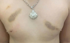 Phụ huynh tố giáo viên bạo hành trẻ, yêu cầu bồi thường 1 năm học phí