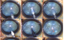 Bác sĩ Việt công bố nghiên cứu mới trên tạp chí nhãn khoa hàng đầu thế giới