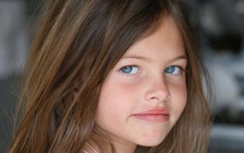 'Bé gái đẹp nhất thế giới' ra sao sau 18 năm?