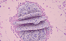 Các nhà khoa học tạo ra 'vũ khí tàng hình' tiêu diệt ung thư