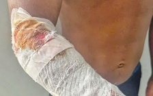 Đang câu cá, bị cá sấu tấn công