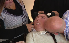 Phép màu cô gái không có não vẫn sống đến 20 tuổi