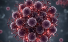 Liệu pháp đột phá loại bỏ ung thư chỉ sau 3 tháng