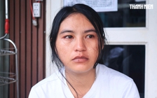 Bé trai nguy cơ mất ánh sáng vì ung thư mắt, gia đình kiệt quệ cầu cứu