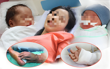 Sản phụ song thai được nối bàn tay đứt lìa ở TP.HCM: 'Tôi bật khóc'