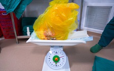 Phẫu thuật lấy khối u xơ tử cung nặng 4 kg cho bệnh nhân