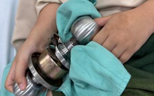 Bác sĩ 'hóa thợ khóa' cứu bé trai 5 tuổi kẹt ngón tay vào ổ khóa