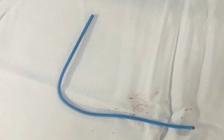 Bệnh viện Quân y 175 tiếp nhận ca bệnh bị dị vật kẹt trong tim hiếm gặp