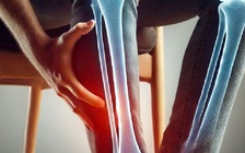 4 dấu hiệu cảnh báo mức vitamin D trong máu đang thấp