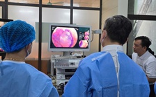 'Công nghệ ánh sáng' giúp chẩn đoán sớm ung thư đại tràng