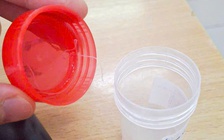 Ký sinh trùng 10 cm sống trong mắt bệnh nhân