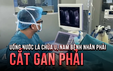 Uống thuốc lá chữa u ở gan, nam bệnh nhân phải cắt toàn bộ gan phải vì u có kích thước 'khổng lồ'