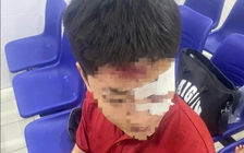 TP.HCM: Nhiều người xông vào hành hung 3 nhân viên nhà xe