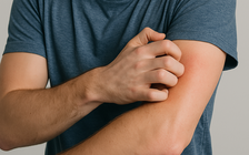 4 dấu hiệu cảnh báo bạn không thực sự khỏe mạnh, chớ xem thường!