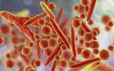 Vi khuẩn liên quan bệnh hô hấp ở Nga từng ghi nhận tại Việt Nam