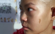 Con muốn sống: Cuộc chiến ung thư của cô bé 16 tuổi và ước mơ dang dở