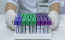 Xét nghiệm máu không phát hiện sớm ung thư đại trực tràng