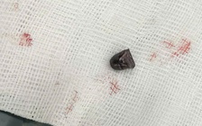 Đồng Nai: Bắt giữ nghi phạm dùng súng bắn tài xế xe tải