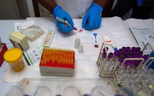 Mỹ chứng nhận thuốc ngừa HIV Yeztugo của Gilead Sciences