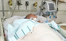 TP.HCM: 2 bệnh nhân viêm não do biến chứng Zona thần kinh hiếm gặp