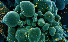 WHO công bố báo cáo mới về nguồn gốc Covid-19, kêu gọi Trung Quốc thông tin thêm