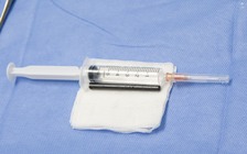 Người đàn ông ở Đồng Nai bị hàng xóm đâm đũa nhựa vào mắt