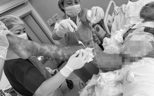 Bệnh viện Quân y 175 cứu nữ bệnh nhân bong tróc 92% da, thoát cửa tử thần