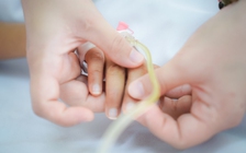 Kỳ tích cứu sống bé trai 10 tuổi bị nhánh cây rơi trúng đầu