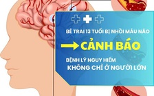 Bé trai 13 tuổi nhồi máu não, cảnh báo nguy cơ đột quỵ ở thiếu niên